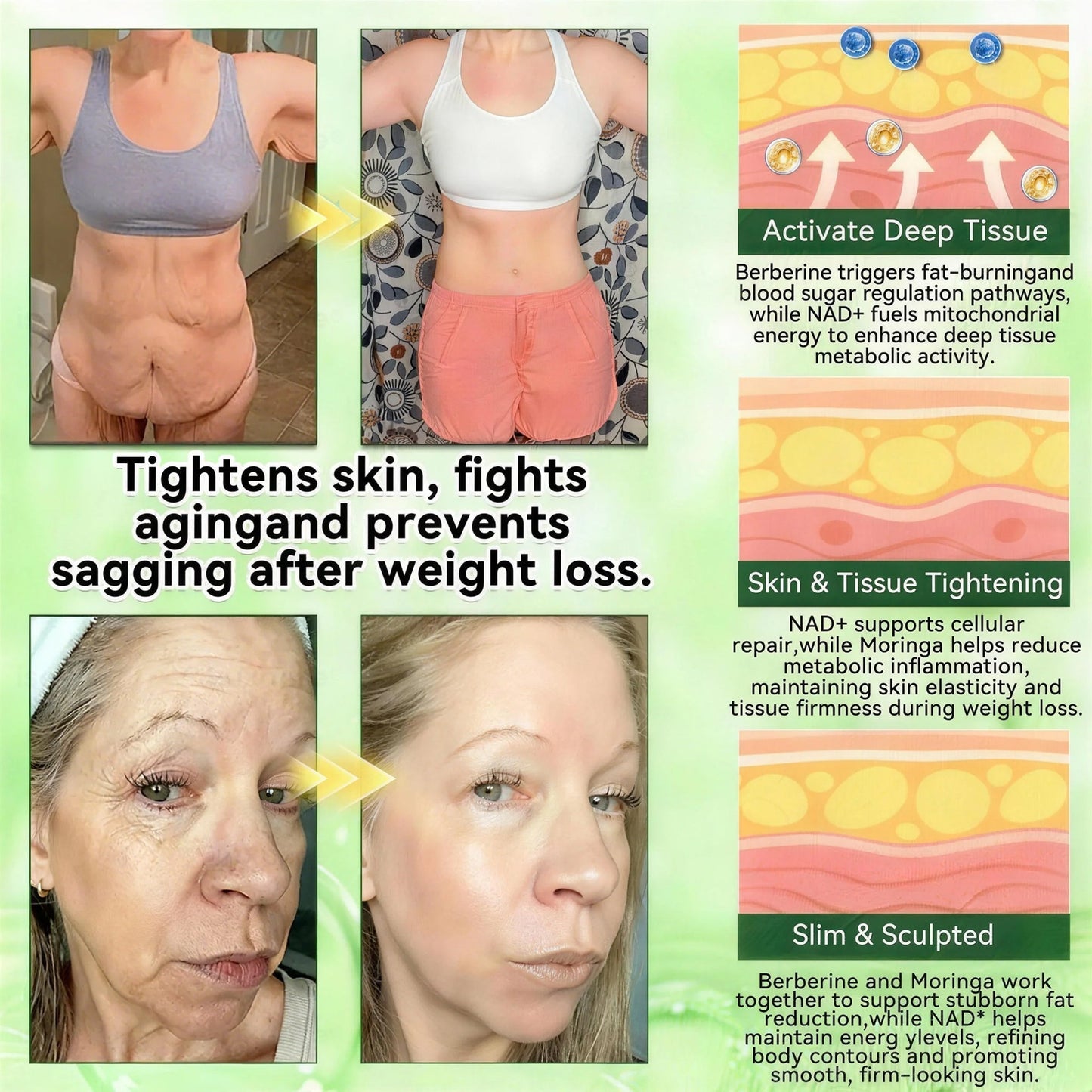𝗢𝗳𝗳𝗶𝗰𝗶𝗮𝗹 𝘀𝘁𝗼𝗿𝗲 🚑 | 𝖲𝗎𝗋𝗀𝗈ᴎ𝗂𝗑® 𝖬𝗈𝗋𝗂𝗇𝗀ɑ · Β𝖾𝗋𝖻𝖾𝗋𝗂𝗇𝖾 & 𝖭𝖠𝖣＋ 10-𝒊𝒏-1 𝑨𝒅𝒗ɑ𝒏𝒄𝒆𝒅 𝑵ɑ𝒏𝒐 𝑴𝒊𝒄𝒓𝒐𝒏𝒆𝒆𝒅𝒍𝒆 𝑷ɑ𝒕𝒄𝒉 𝑪𝒐𝒎𝒃ɑ𝒕 𝒐𝒃𝒆𝒔𝒊𝒕𝒚, 𝒔ɑ𝒈𝒈𝒊𝒏𝒈 𝒔𝒌𝒊𝒏, 𝒅𝒊ɑ𝒃𝒆𝒕𝒆𝒔, 𝒔𝒍𝒆𝒆𝒑 ɑ𝒑𝒏𝒆ɑ, 𝒋𝒐𝒊𝒏𝒕 𝒊𝒔𝒔𝒖𝒆𝒔 & 𝒎𝒐𝒓𝒆🚀